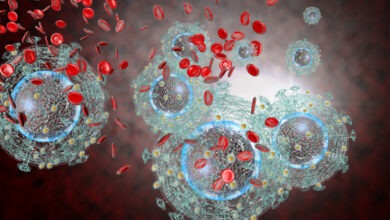 test HIV